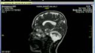 IQ view Workstation dicom Risonanza