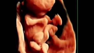 10 weeks baby dancing Voluson E8 Expert 4D HD Live GENESYS FERTILITY CENTER