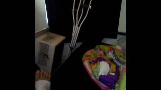 Sprained. Ankle