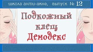40| Демодекс нам НЕ ВРАГ |  Демодекоз и акне | Компресс, гидролат, ДЕМОТЕН, питание и режим