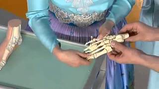 Неврома Мортона. Жить здорово! Почему болят ноги?