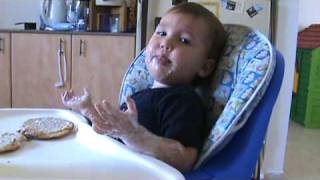new chicken pox remedy