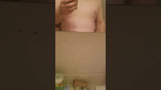 Self physical exam pt 1
