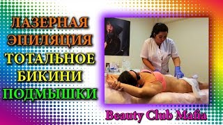 ЛАЗЕРНАЯ ЭПИЛЯЦИЯ БИКИНИ ? ТОТАЛЬНОЕ БИКИНИ ГЛУБОКОЕ | ЭПИЛЯЦИЯ ПОДМЫШЕК | МАФИЯ - ЭПИЛЯЦИЯ В СОЧИ