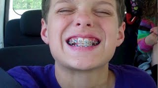 Caleb Gets Braces (WK 121.3)