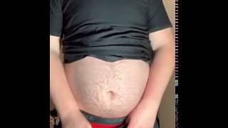 FAT BELLY BREAKS BUTTON ON PANTS