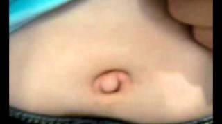 Gross belly button :)