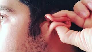 Ear pull, twist