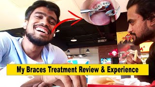 All About My Braces Treatment Vlog with Right Information ||@Grooming Brothers IN HINDI