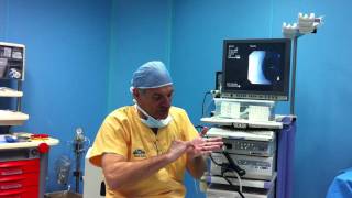 TRATTAMENTO ENDOSCOPICO PER LA SINDROME DEL TUNNEL CARPALE