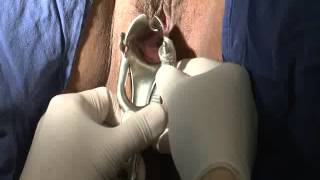 CMU - PAP Smear preparation