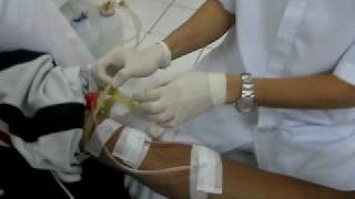 HEMODIALYSIS Procedure