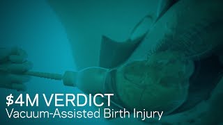 $4M Verdict Animating Vacuum-Assisted Birth Injury