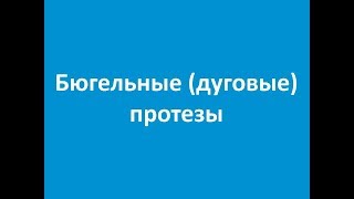 Бюгельные (дуговые) протезы