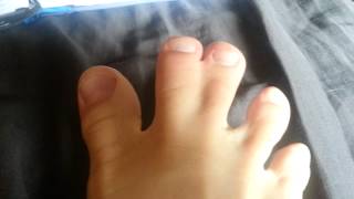 Webbed Toes Part 3