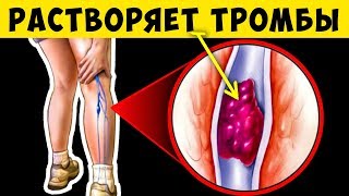 Эти 15 продуктов рекомендуют Флебологи для Растворения Тромбов в Сосудах