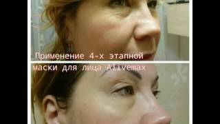 Фото до и после применения спреев Alivemax Часть 2  Папиломы, демодекоз, аллергия, облысение,псориаз
