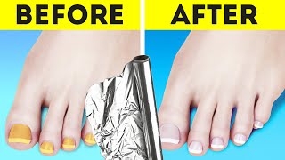 Take care of your feet || Best Nail, Feet and Shoe Hacks