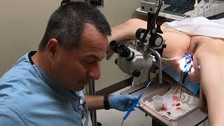 LEEP Procedure with Dr Alberto Cadena