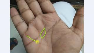 The Great Rectangle Formation in Hand