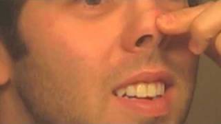 Scot's Amazing Nose Zit   (It Refills)