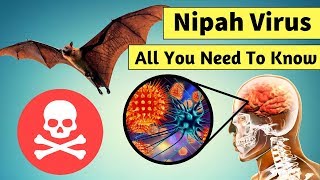 All About Deadly Nipah Virus - Signs, Symptoms & Prevention