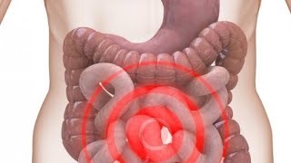 علاج طبيعي ومجرب للقولون العصبي (العلاج سهل وفعال )