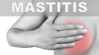 ☞ Remedios caseros para la infección de mamas o mastitis – Dolor en los senos