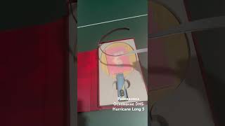 Основание DHS Hurricane Long 5 #настольныйтеннис #tabletennis #теннис #тенниснастольный