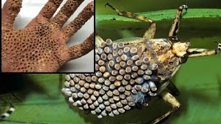 Este Insecto Provoca El DOLOR Más Insoportable que Existe, NO Creerás Cual Es...
