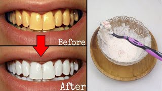 CUKUP 2 MENIT,GIGI KUNING PUTIH KEMBALI, KARANG GIGI RONTOK | TIPS MEMUTIHKAN GIGI DENGAN CARA ALAMI
