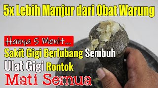 TERUNGKAP SUDAH... TIPS PALING MANJUR ATASI SAKIT SAKIT GIGI BERLUBANG MENAHUN DALAM 5 MENIT