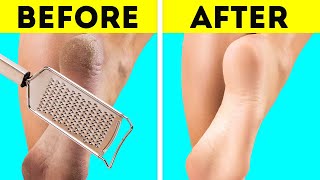 27 Useful Hacks You Have To Know