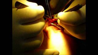 rhinoplasty in belarus