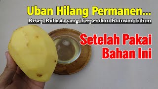CARA MENGHILANGKAN UBAN SAMPAI KE AKAR-AKARNYA, CUKUP GUNAKAN INI