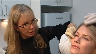 Sunrise - Vampire facials - Are they safe?