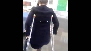 LAK  Amputee Woman