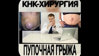 Пупочная грыжа
