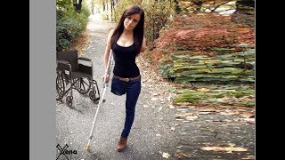 amputee, Natalie is visiting Berlin