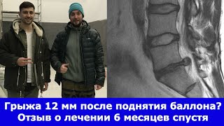 Грыжа 12 мм уменьшилась в 2 раза за 6 месяцев. Отзыв о лечении