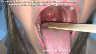 Examen físico - Boca y orofaringe