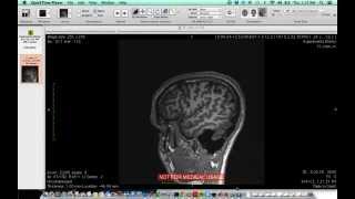 Use OsiriX to view DICOM/.IMA files
