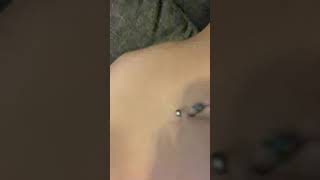 Stomach Noises after Drinking