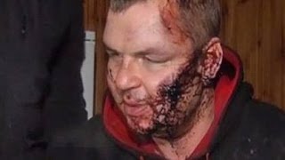 Майдан: Распятие и пытки над Дмитрием Булатовым / A24