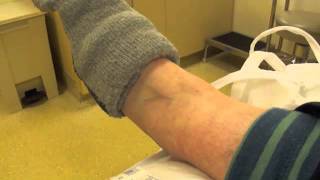 Broken Left Ankle When Ellie Rolls in the Snow
