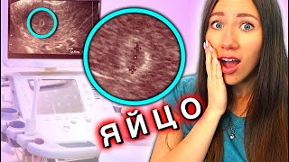 САМОЕ ПЕРВОЕ УЗИ РЕБЕНКА 5 недель ?? ПЕРВОЕ ВИДЕО малыша ? Я беременна | Elli Di