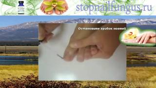 Лучший крем против грибка ногтей!