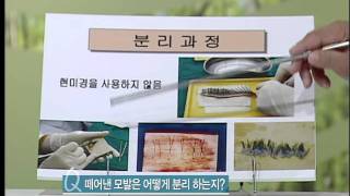 [전주피부과/모발이식]모래내피부과 강광영원장님 - 닥터 MBC 출연