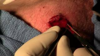 Gross knee footage 5