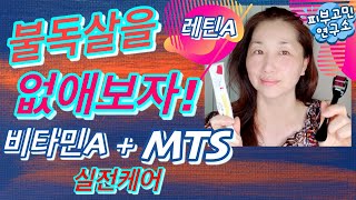 레틴a 사용법 + MTS 더마롤러⎮ 쳐진 볼살, 불독살, 팔자 주름, 무너진 턱선 살리는 홈케어 방법⎮비타민a 레티놀 레틴a 관리법+ MTS 니들 더마롤러 사용하는 방법